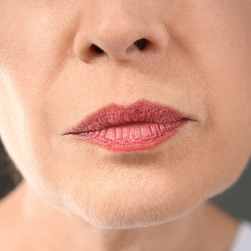 AMWC Dubai - Mature lips